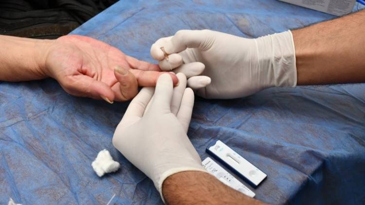 Salud informa los centros de notificación para la vigilancia del Chagas